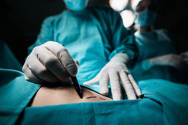 Reconstrucţia sânului după mastectomie: de la vindecare la un rezultat estetic impresionant Reconstrucţia sânului după mastectomie: de la vindecare la un rezultat estetic impresionant