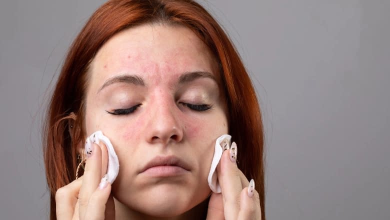 Dermatologii avertizează Dermatologii avertizează